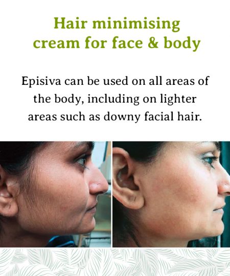 episiva (4)